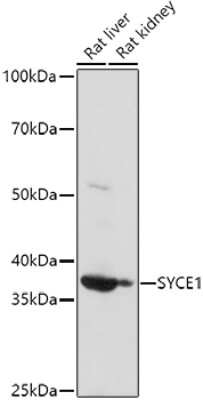 Western Blot: SYCE1 AntibodyBSA Free [NBP2-93023]